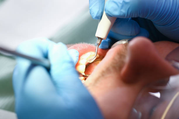 Best Emergency Dental Care for Sports Injuries in Martins Additions, MD